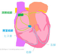不整脈の治療法と2種類の徐脈(洞不全症候群、房室ブロック)